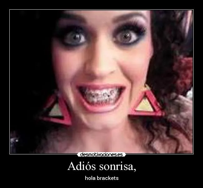 Sonrisas con brackets desmotivaciones - Imagui Sonrisas con brackets desmotivaciones - Imagui