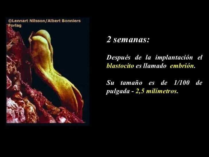 tema-4-desarrollo-sistema- ...