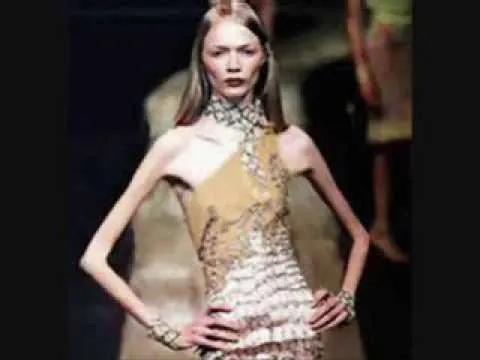 Terá Mary-Kate Olsen feito uma operação plástica? - WorldNews