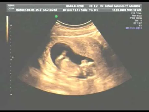 TINO Y JESSICA - NUESTRO BEBE EN EL VIENTRE DE SU MAMI - 15 ENERO ...