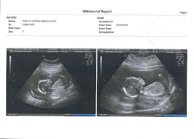 Como bien sabemos ya todos, Inma y Javi también van a ser papas!!!. Como bien sabemos ya todos, Inma y Javi también van a ser papas!!!.