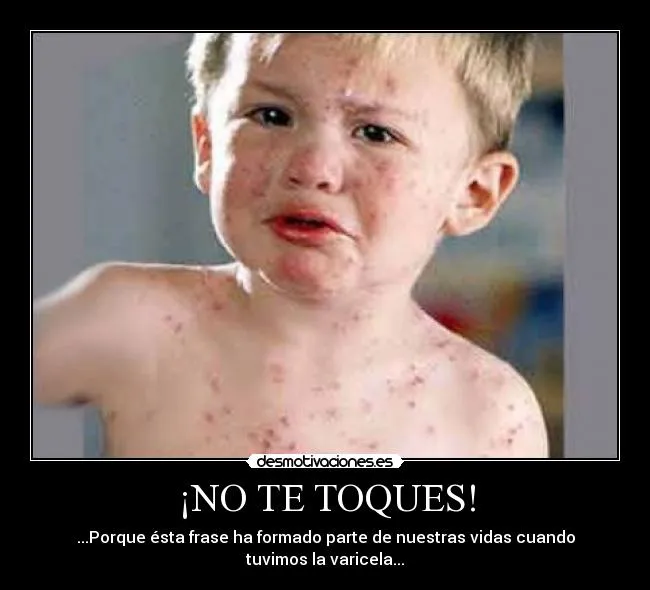 NO TE TOQUES! | Desmotivaciones