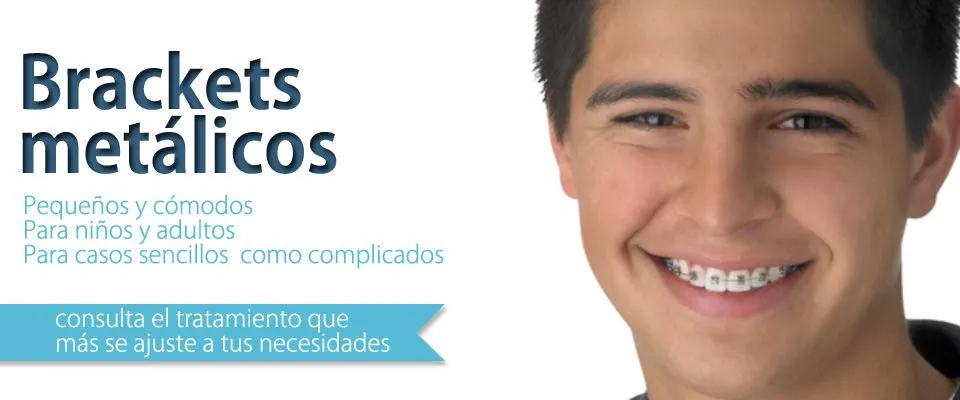 Tratamientos dentales - Dental Bugambilias