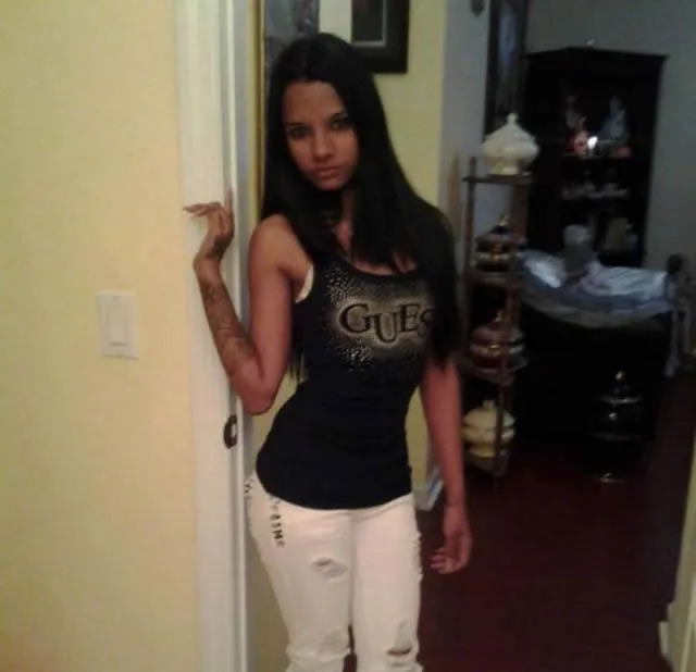 La triste historia de Linda Pérez, una víctima de la cirugía ...