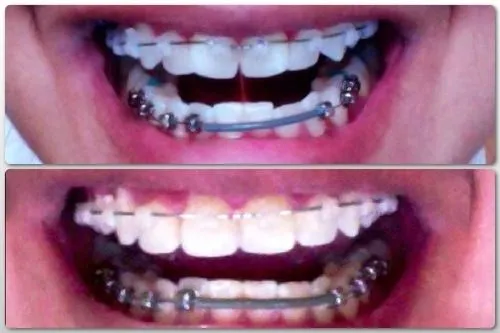 Изобр по > Brackets Tumblr