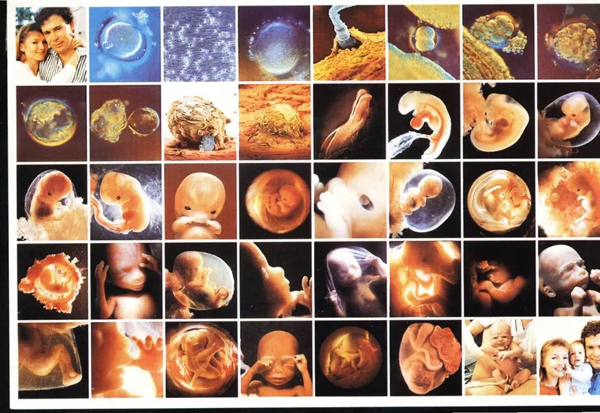 ... un tumor a un feto sacándolo de forma parcial del cuerpo de la madre ... un tumor a un feto sacándolo de forma parcial del cuerpo de la madre