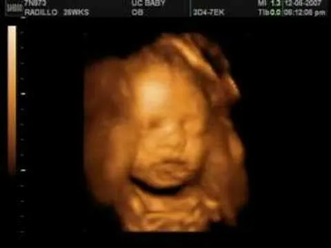 Ultrasonido 3D/4D - Nathaniel (Parte 2) - YouTube Ultrasonido 3D/4D - Nathaniel (Parte 2) - YouTube