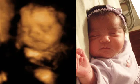 Imagenes de ultrasonidos de 4 meses - Imagui Imagenes de ultrasonidos de 4 meses - Imagui