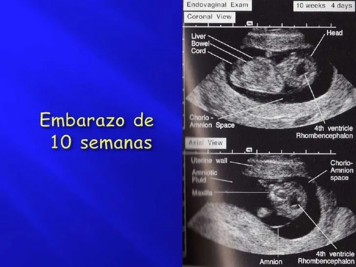 ultrasonido-en-la-mujer-19-728 ...