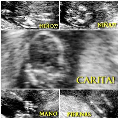 Ultrasonido ¿Es niño o niña? | Diario de mi embarazo: 16 semanas Ultrasonido ¿Es niño o niña? | Diario de mi embarazo: 16 semanas