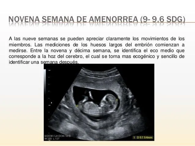 ultrasonido del primer trimestre