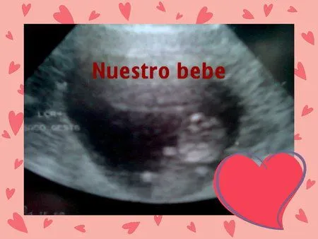 aun tienen los ultrasonidos De sus bebes :D - Septiembre 2011 ... aun tienen los ultrasonidos De sus bebes :D - Septiembre 2011 ...