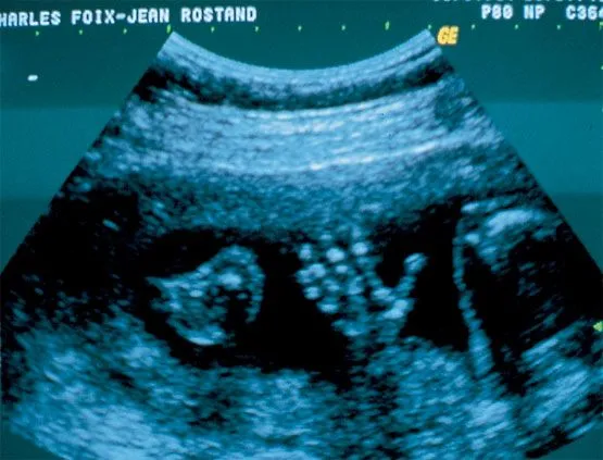 Ultrasonidos. | newsoundessence