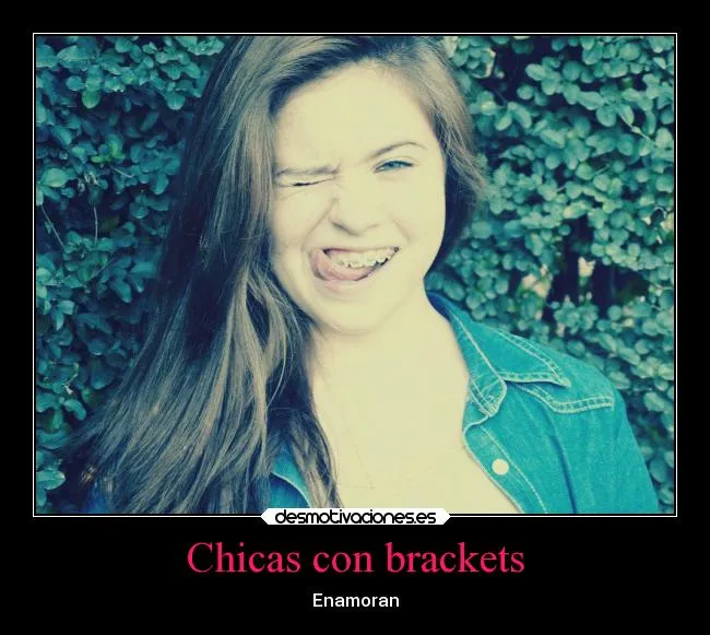 Chicas con brackets | Desmotivaciones