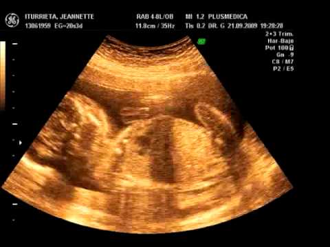 Valeria Trinidad 5 meses de embarazo - YouTube Valeria Trinidad 5 meses de embarazo - YouTube