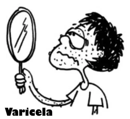 Varicela para colorear - Imagui