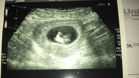 Como se ve un bebé de 7 semanas - Imagui