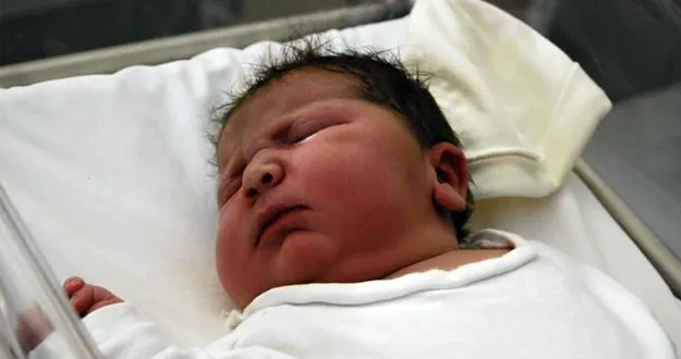 VERSION INTERNA: MACROSOMÍA FETAL: ¡QUÉ GORDO Y SANO ESTÁ MI BEBÉ! VERSION INTERNA: MACROSOMÍA FETAL: ¡QUÉ GORDO Y SANO ESTÁ MI BEBÉ!