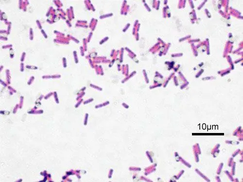 Ves “bacterias” en el cielo? Sobre el cristalino, la retina y el ...