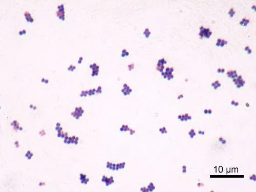 Ves “bacterias” en el cielo? Sobre el cristalino, la retina y el ...
