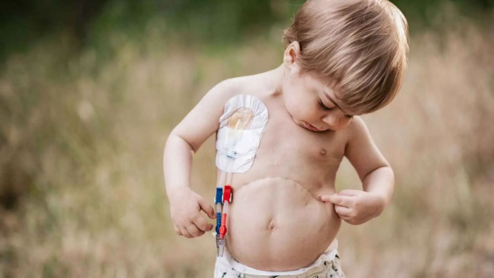 La vida al límite de Mateo por el gen NEK8: 