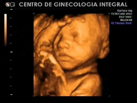 Video ecografía 4D - 27 semanas - YouTube