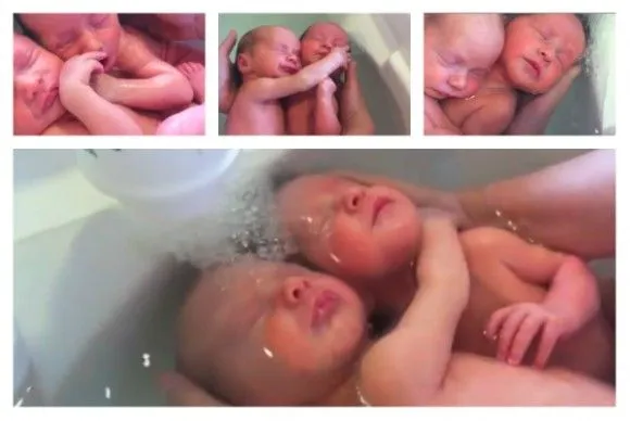 Video de gemelos recién nacidos conmueve al mundo (+ Fotos y Video ... Video de gemelos recién nacidos conmueve al mundo (+ Fotos y Video ...