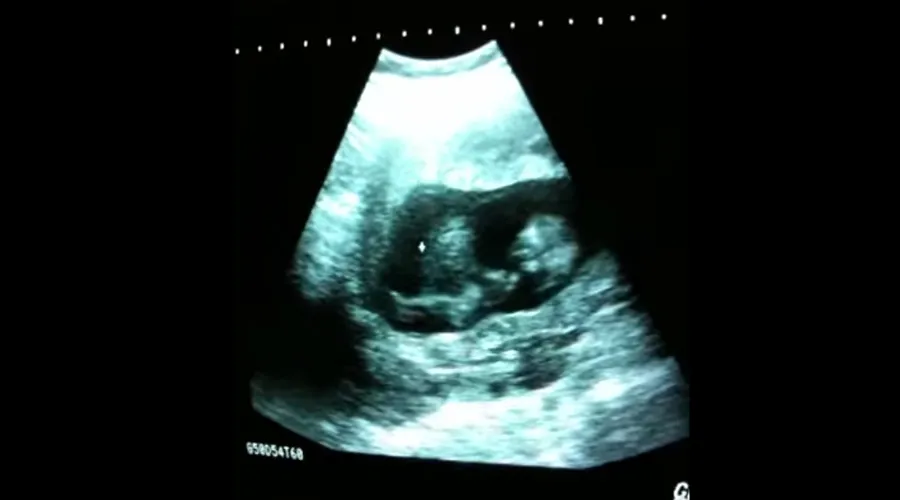 VIDEO VIRAL] Tiene menos de tres meses de gestación y juega en el ...