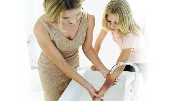 Vídeos para aprender a curar heridas, hemorragias y quemaduras