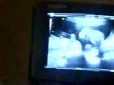 VIDEOS DE ECOGRAFIAS | Videos « PortaldeNoticias.COM VIDEOS DE ECOGRAFIAS | Videos « PortaldeNoticias.COM