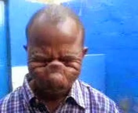 VIDEOS INCREÍBLES: El hombre mas feo del mundo ¡increible! VIDEOS INCREÍBLES: El hombre mas feo del mundo ¡increible!