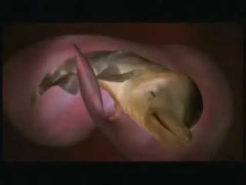 En el vientre materno - Animales (El Delfin) 3/4 - YouTube