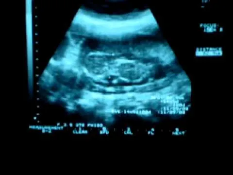 En el vientre materno 3 meses 5 dias - YouTube