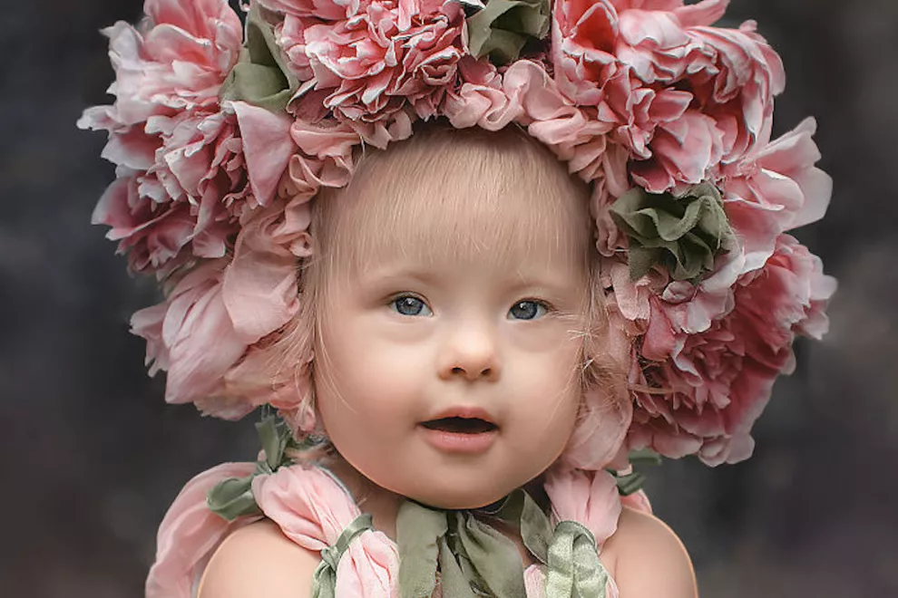 Se hizo viral por las adorables fotos de su hija. “Muchos piensan que los niños con Síndrome de Down son feos y no pueden mostrar sus emociones” - Ohlalá Se hizo viral por las adorables fotos de su hija. “Muchos piensan que los niños con Síndrome de Down son feos y no pueden mostrar sus emociones” - Ohlalá